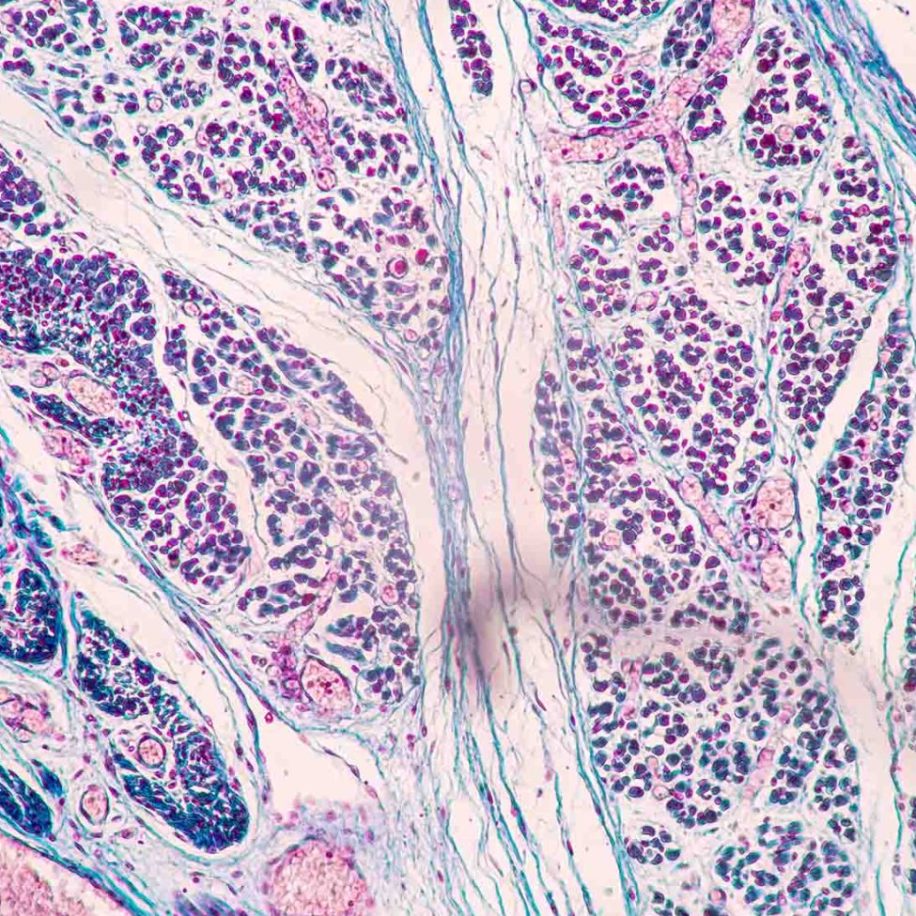 Tissue-of-Thyroid-gland-Lymph-gland-Larynx-of-human-and-Human-blood-cells-study-under-microscopi-aspect-ratio-1600-975