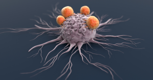 Cancer cell attacked by lymphocytes