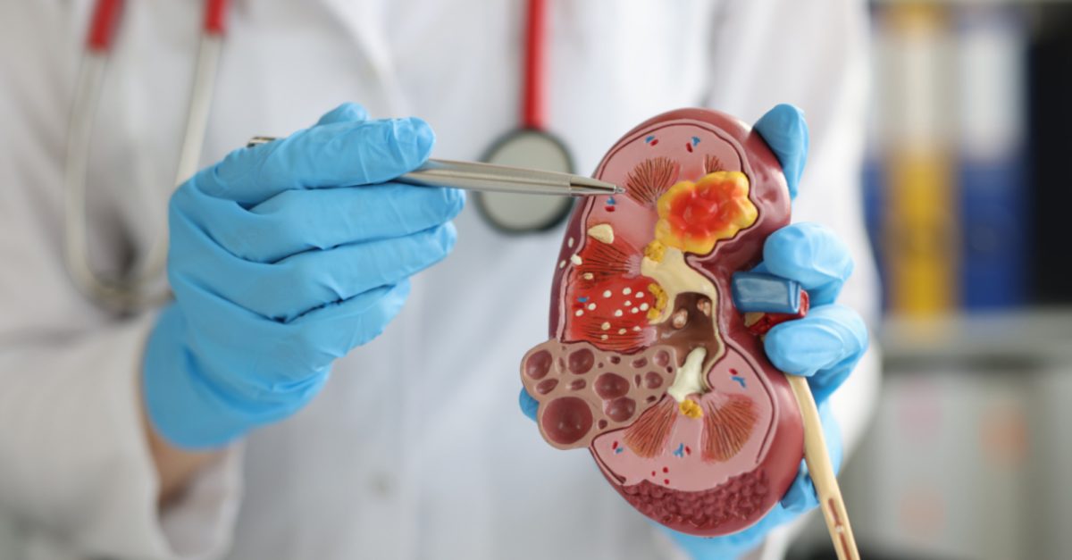 Avance Clinical Launches Renal and Cardiometabolic Center of Excellence to Optimize Patient Recruitment to Elevate Study Success