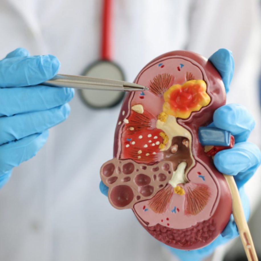 Kidney-Image-aspect-ratio-1600-975