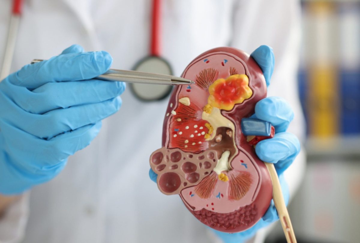 Avance Clinical Launches Renal and Cardiometabolic Center of Excellence to Optimize Patient Recruitment to Elevate Study Success Avance Clinical Launches Renal and Cardiometabolic Center of Excellence to Optimize Patient Recruitment to Elevate Study Success
