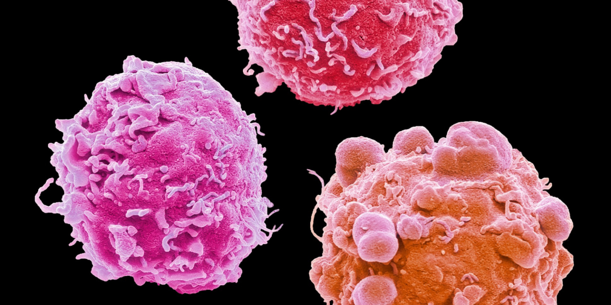 Avance Clinical to Showcase Oncology Leadership at ASCO Annual Meeting 2026