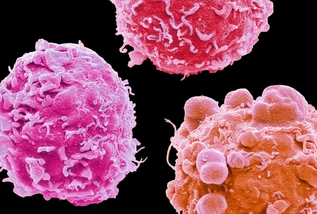Avance Clinical to Showcase Oncology Leadership at ASCO Annual Meeting 2026 Avance Clinical to Showcase Oncology Leadership at ASCO Annual Meeting 2026
