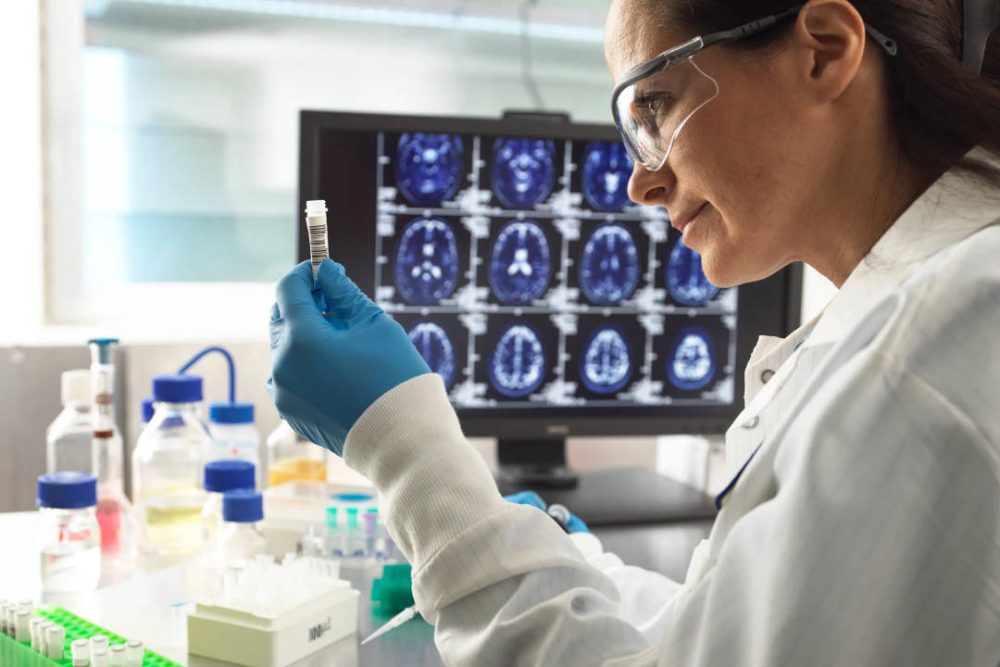 7 Alzheimer’s Biomarkers That Inform Trial Design